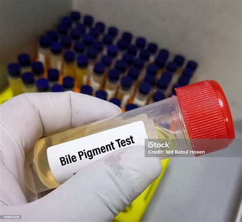 laboratory analysis of urine|analyze your urine yourself.